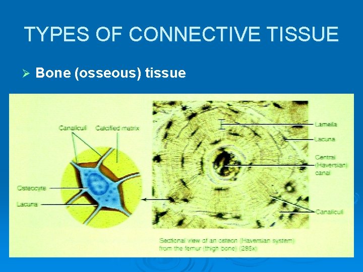 TYPES OF CONNECTIVE TISSUE Ø Bone (osseous) tissue 