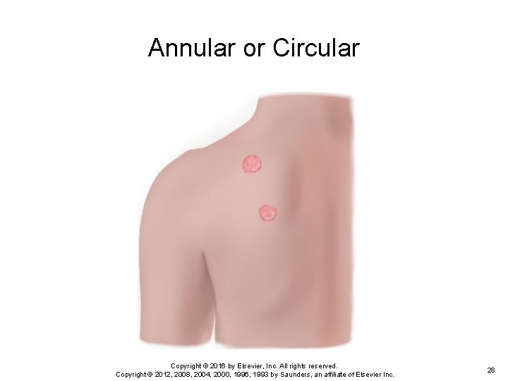 Annular or Circular Copyright © 2016 by Elsevier, Inc. All rights reserved. Copyright © Annular or Circular Copyright © 2016 by Elsevier, Inc. All rights reserved. Copyright ©