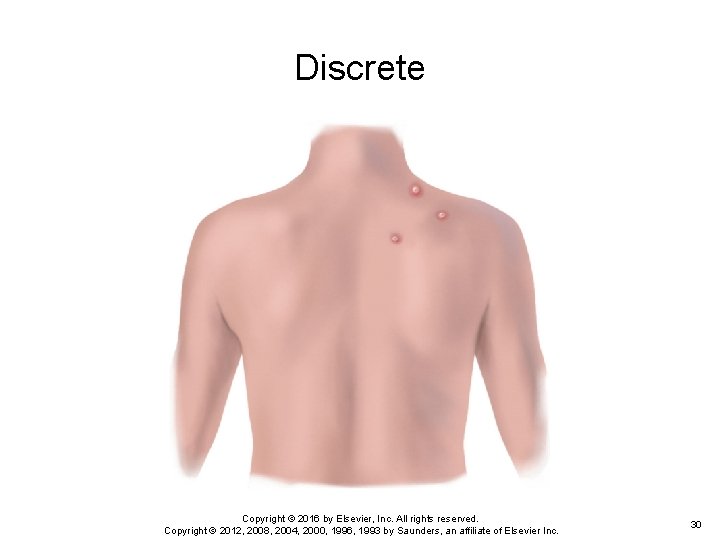 Discrete Copyright © 2016 by Elsevier, Inc. All rights reserved. Copyright © 2012, 2008, Discrete Copyright © 2016 by Elsevier, Inc. All rights reserved. Copyright © 2012, 2008,