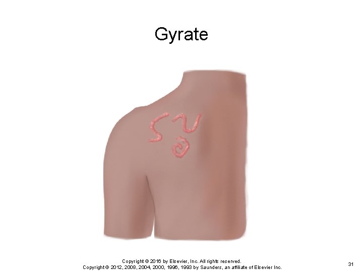 Gyrate Copyright © 2016 by Elsevier, Inc. All rights reserved. Copyright © 2012, 2008, Gyrate Copyright © 2016 by Elsevier, Inc. All rights reserved. Copyright © 2012, 2008,