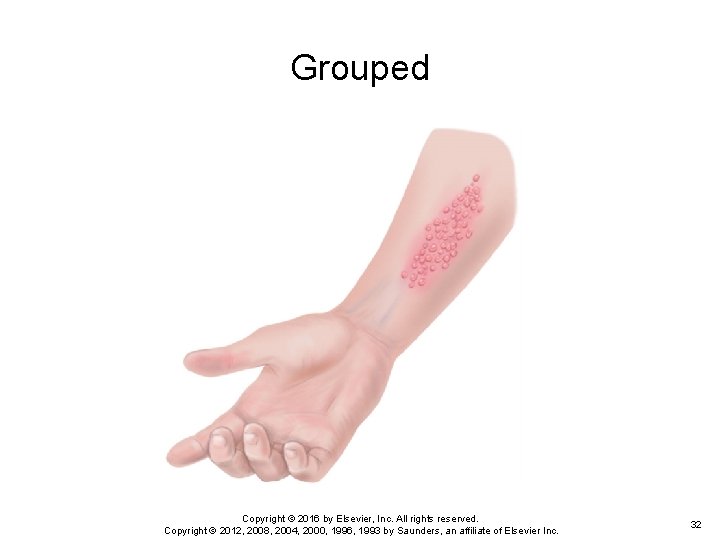 Grouped Copyright © 2016 by Elsevier, Inc. All rights reserved. Copyright © 2012, 2008, Grouped Copyright © 2016 by Elsevier, Inc. All rights reserved. Copyright © 2012, 2008,