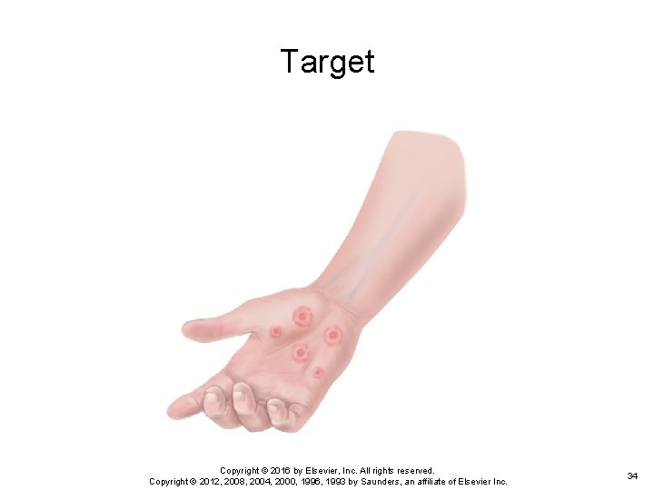 Target Copyright © 2016 by Elsevier, Inc. All rights reserved. Copyright © 2012, 2008, Target Copyright © 2016 by Elsevier, Inc. All rights reserved. Copyright © 2012, 2008,