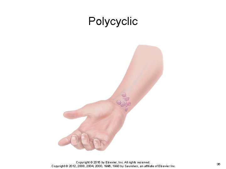 Polycyclic Copyright © 2016 by Elsevier, Inc. All rights reserved. Copyright © 2012, 2008, Polycyclic Copyright © 2016 by Elsevier, Inc. All rights reserved. Copyright © 2012, 2008,