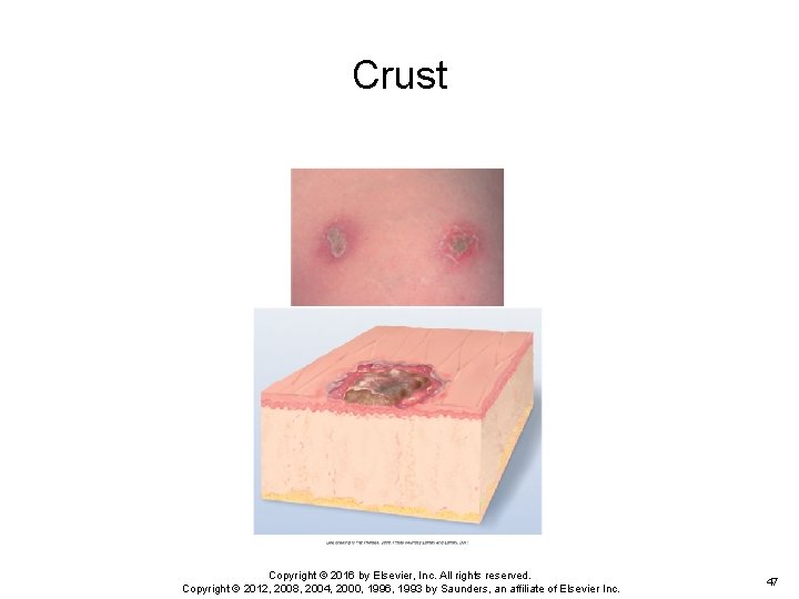 Crust Copyright © 2016 by Elsevier, Inc. All rights reserved. Copyright © 2012, 2008, Crust Copyright © 2016 by Elsevier, Inc. All rights reserved. Copyright © 2012, 2008,
