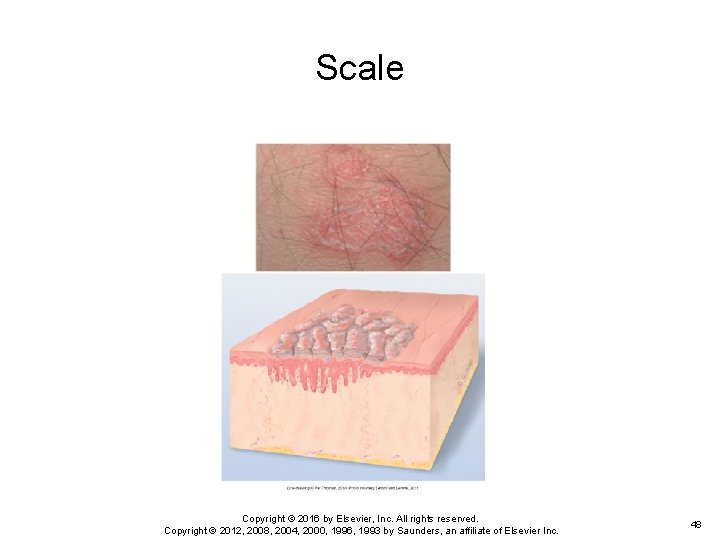 Scale Copyright © 2016 by Elsevier, Inc. All rights reserved. Copyright © 2012, 2008, Scale Copyright © 2016 by Elsevier, Inc. All rights reserved. Copyright © 2012, 2008,