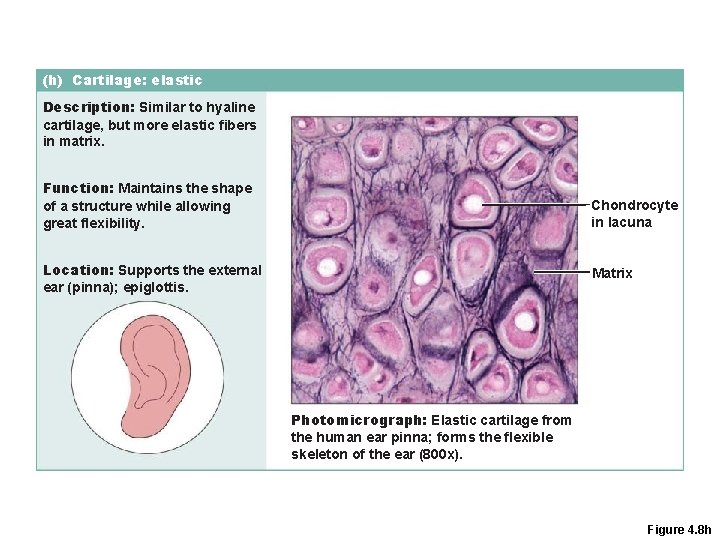 (h) Cartilage: elastic Description: Similar to hyaline cartilage, but more elastic fibers in matrix.