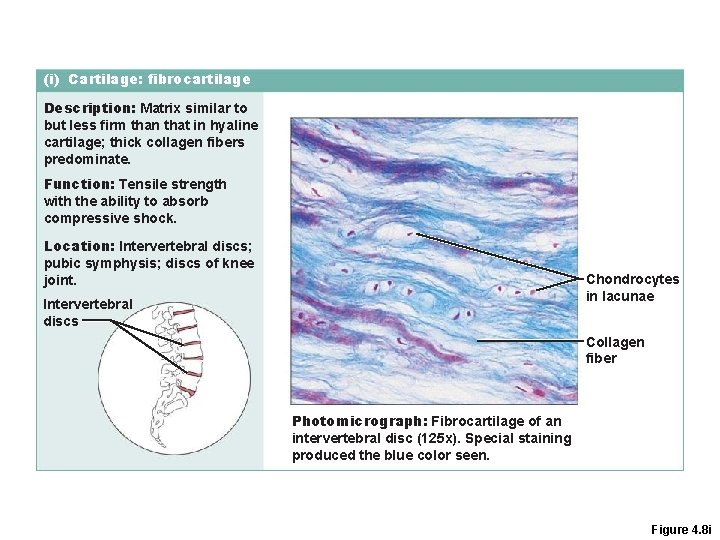 (i) Cartilage: fibrocartilage Description: Matrix similar to but less firm than that in hyaline