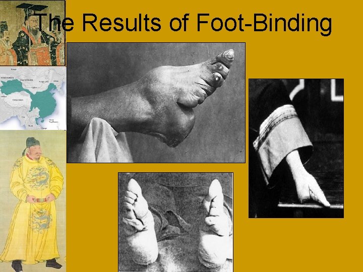 The Results of Foot-Binding Sui, Tang and Song China 