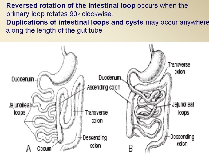 Reversed rotation of the intestinal loop occurs when the primary loop rotates 90◦ clockwise.