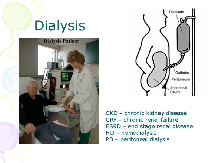 Dialysis CKD – chronic kidney disease CRF – chronic renal failure ESRD – end