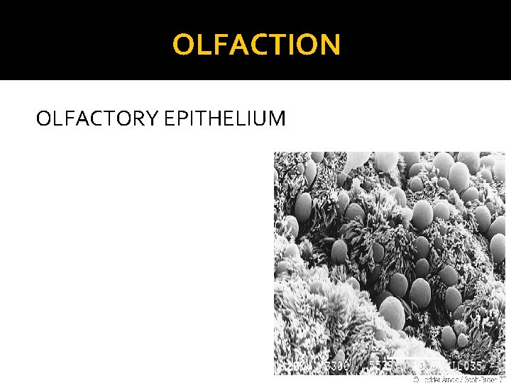 OLFACTION OLFACTORY EPITHELIUM 