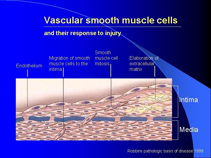 Vascular smooth muscle cells and their response to injury Endothelium Smooth Migration of smooth