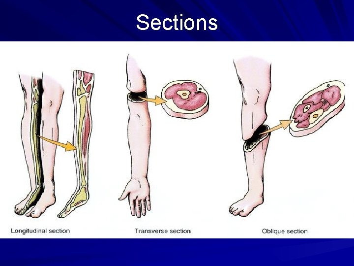 Sections 