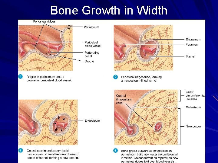 Bone Growth in Width 