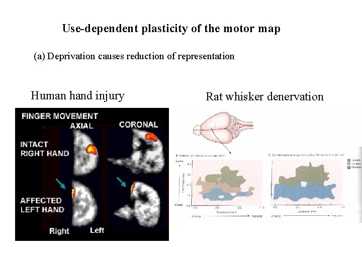Use-dependent plasticity of the motor map (a) Deprivation causes reduction of representation Human hand