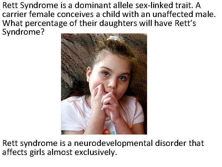 Rett Syndrome is a dominant allele sex-linked trait. A carrier female conceives a child Rett Syndrome is a dominant allele sex-linked trait. A carrier female conceives a child