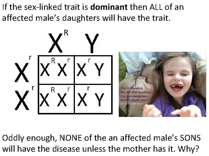 If the sex-linked trait is dominant then ALL of an affected male’s daughters will If the sex-linked trait is dominant then ALL of an affected male’s daughters will