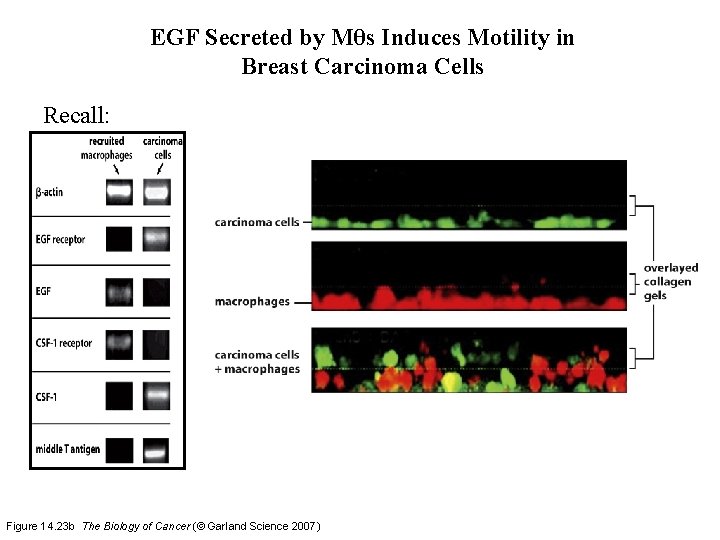 EGF Secreted by Mθs Induces Motility in Breast Carcinoma Cells Recall: Figure 14. 23