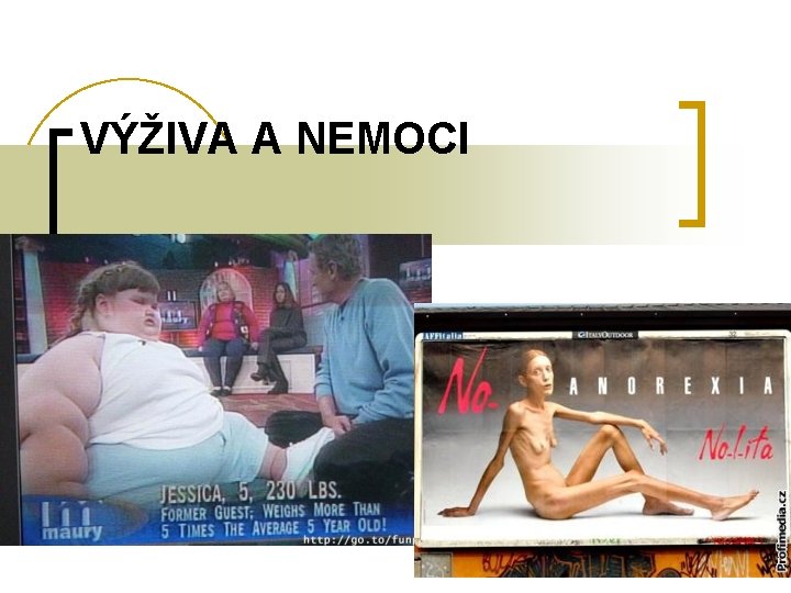 VÝŽIVA A NEMOCI 