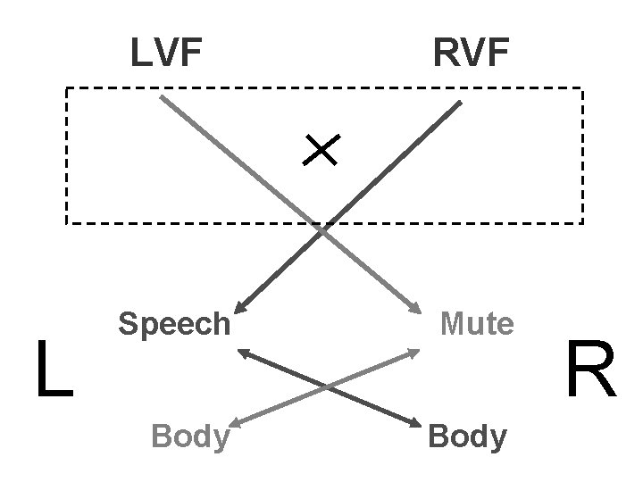 L LVF RVF Speech Mute Body R 