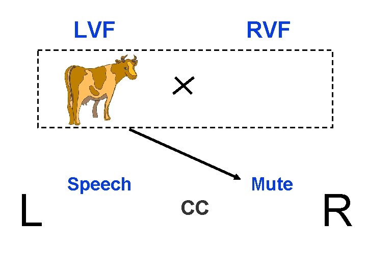 L LVF RVF Speech Mute CC R 