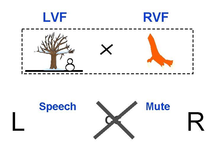 L LVF RVF Speech Mute CC R 