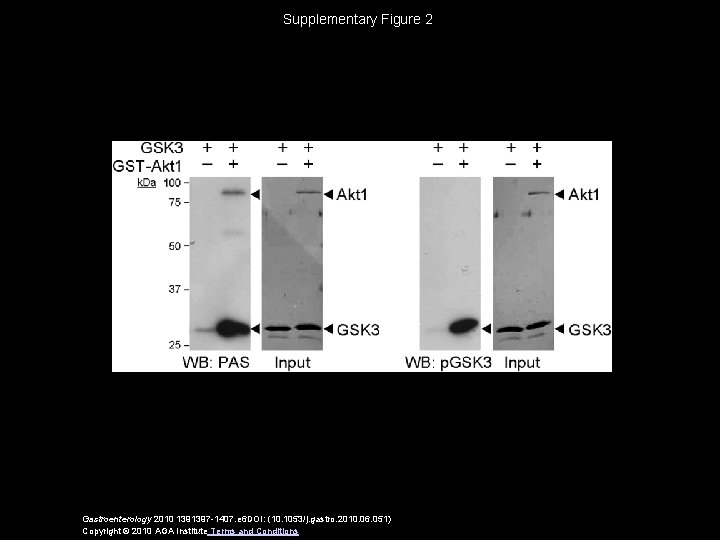 Supplementary Figure 2 Gastroenterology 2010 1391397 -1407. e 6 DOI: (10. 1053/j. gastro. 2010.