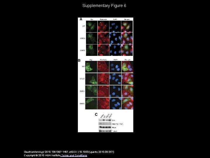 Supplementary Figure 6 Gastroenterology 2010 1391397 -1407. e 6 DOI: (10. 1053/j. gastro. 2010.