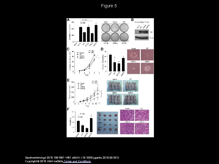 Figure 5 Gastroenterology 2010 1391397 -1407. e 6 DOI: (10. 1053/j. gastro. 2010. 06.