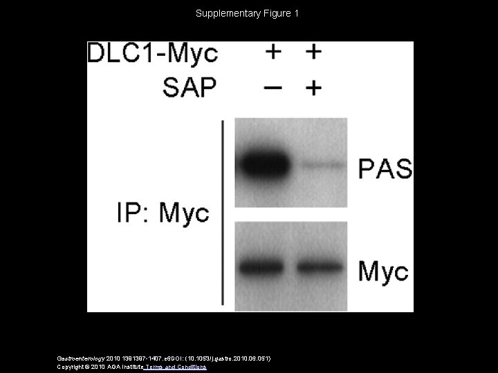Supplementary Figure 1 Gastroenterology 2010 1391397 -1407. e 6 DOI: (10. 1053/j. gastro. 2010.