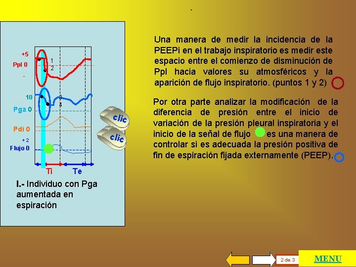 . +5 Ppl 0 Una manera de medir la incidencia de la PEEPi en
