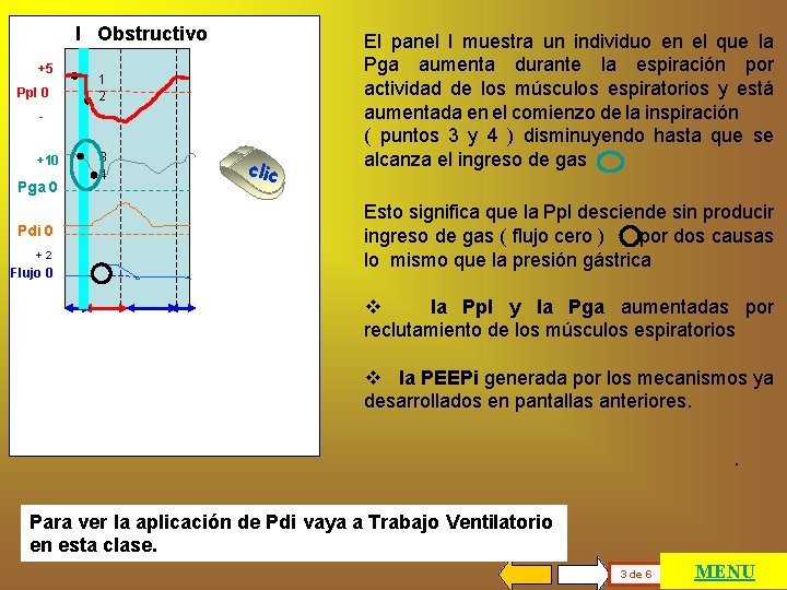 I Obstructivo +5 Ppl 0 1 2 - …. +10 Pga 0 Pdi 0