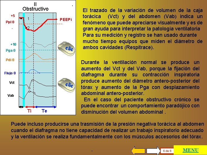 II Obstructivo +5 Ppl 0 - 1 . PEEPi 2 …. +10 clic Pga