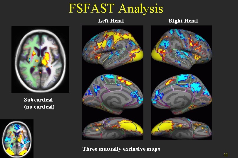 FSFAST Analysis Left Hemi Right Hemi Subcortical (no cortical) Three mutually exclusive maps 11