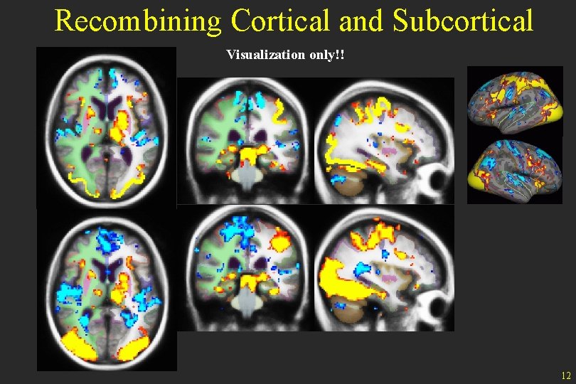 Recombining Cortical and Subcortical Visualization only!! 12 
