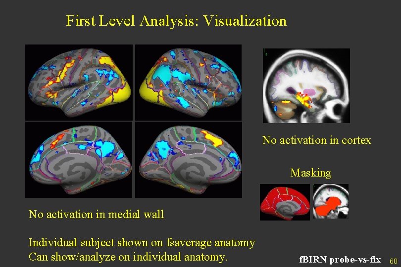 First Level Analysis: Visualization No activation in cortex Masking No activation in medial wall