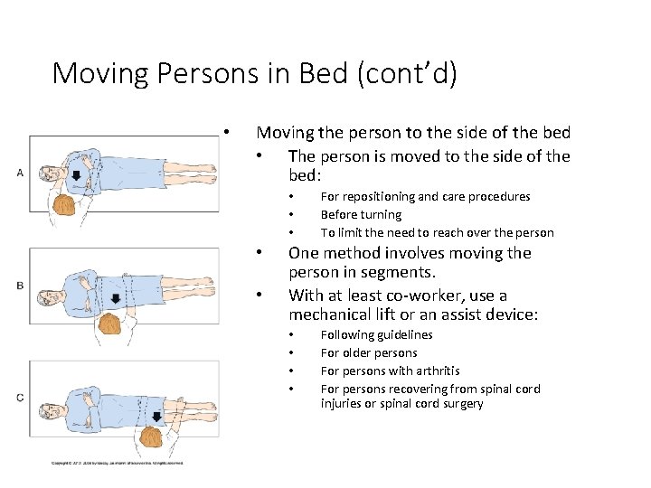 Moving Persons in Bed (cont’d) • Moving the person to the side of the