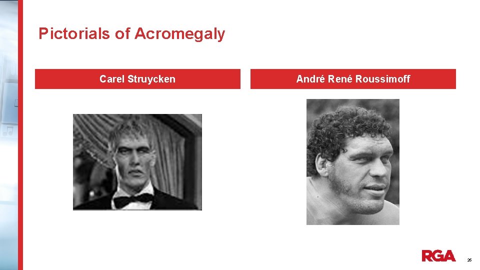 Pictorials of Acromegaly Carel Struycken André René Roussimoff 25 