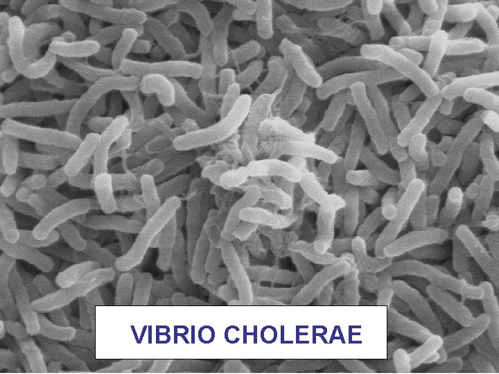 VIBRIO CHOLERAE 