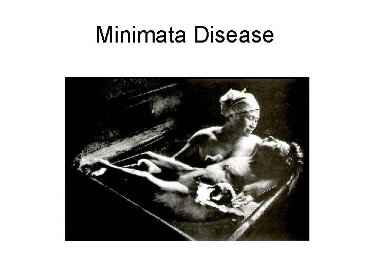 Minimata Disease 