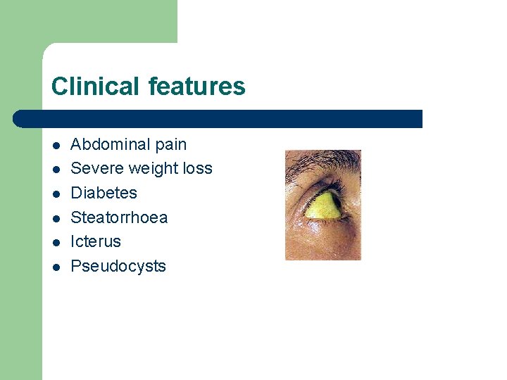 Clinical features l l l Abdominal pain Severe weight loss Diabetes Steatorrhoea Icterus Pseudocysts Clinical features l l l Abdominal pain Severe weight loss Diabetes Steatorrhoea Icterus Pseudocysts