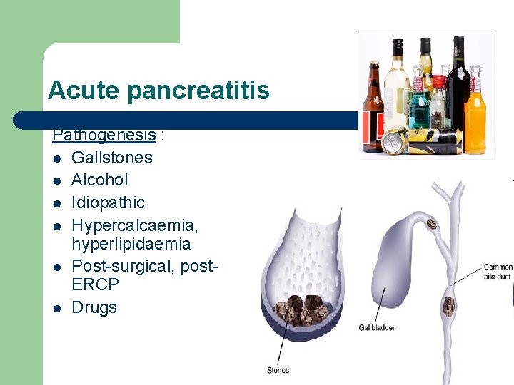 Acute pancreatitis Pathogenesis : l Gallstones l Alcohol l Idiopathic l Hypercalcaemia, hyperlipidaemia l