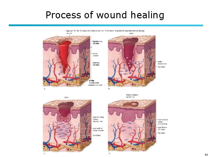 Process of wound healing 31 