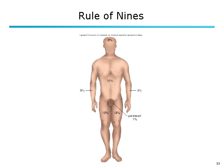 Rule of Nines 33 
