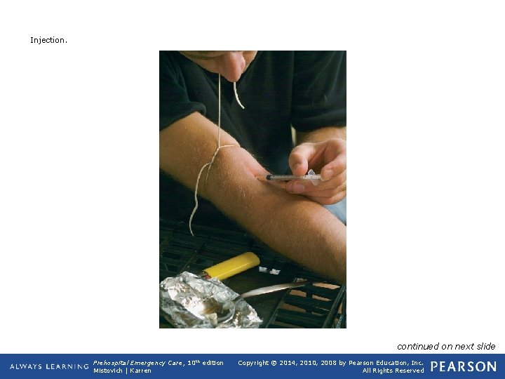 Injection. continued on next slide Prehospital Emergency Care, 10 th edition Mistovich | Karren