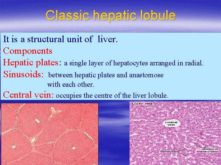 Classic hepatic lobule It is a structural unit of liver. Components Hepatic plates: a