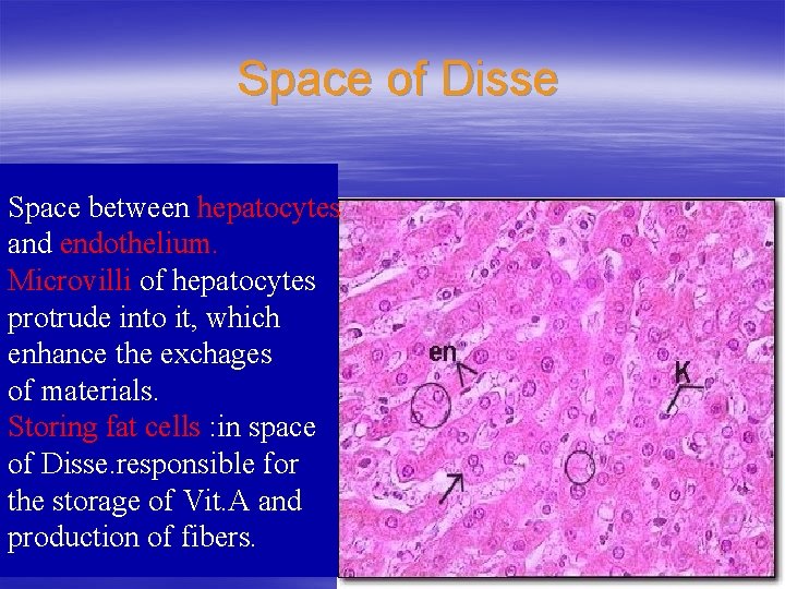 Space of Disse Space between hepatocytes and endothelium. Microvilli of hepatocytes protrude into it,