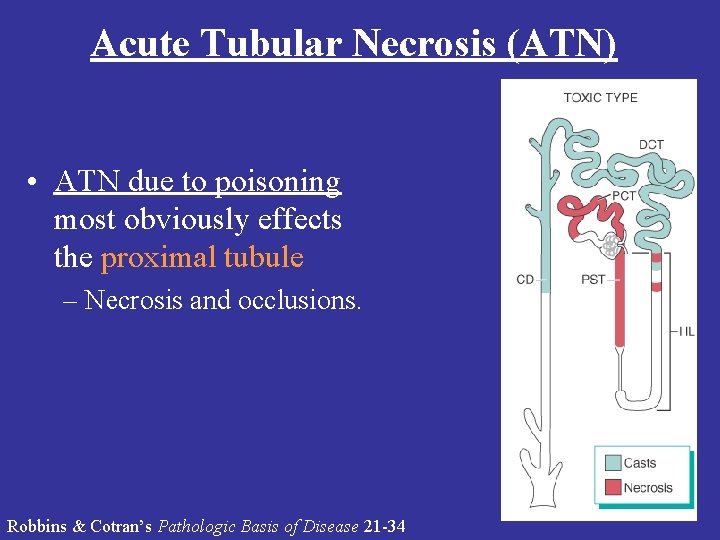 Acute Tubular Necrosis (ATN) • ATN due to poisoning most obviously effects the proximal