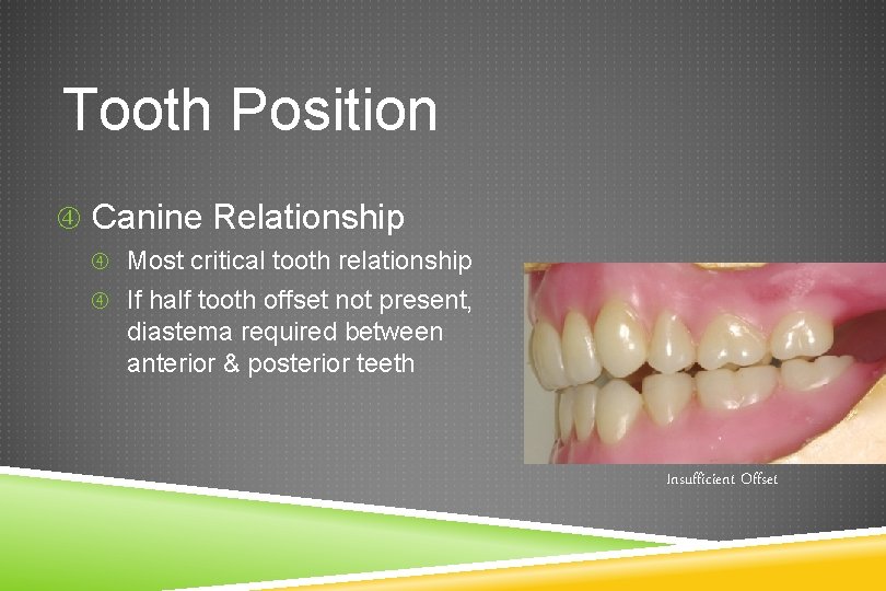 Tooth Position Canine Relationship Most critical tooth relationship If half tooth offset not present,