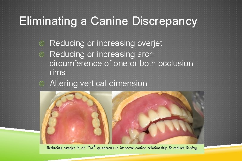 Eliminating a Canine Discrepancy Reducing or increasing overjet Reducing or increasing arch circumference of
